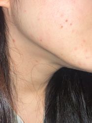 -万州华美紫馨整形美容医院