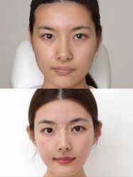 -Yestar重庆艺星医疗美容医院