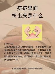 -克丽缇娜