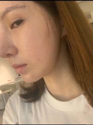 -大华韩艺整形美容医院