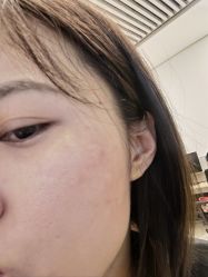 体验前-深圳医恒美医疗美容