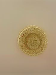点击看大图 -香薇妮丝女子减肥院