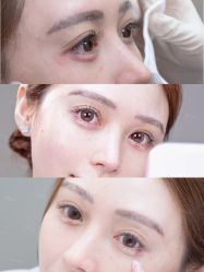 -深圳艺星医疗美容医院