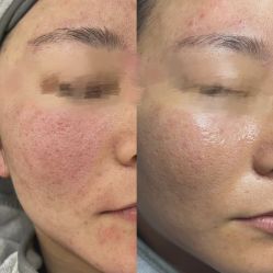 -Cream88颜皮肤管理中心