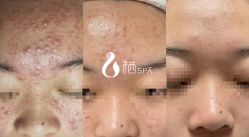 -栖SPA·ONDA ·海菲秀·皑皑科技美肤中心