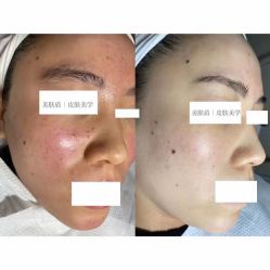 -美肤盾祛痘·问题肌头疗管理中心