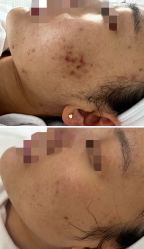 -康美贞·痘肌养护管理中心