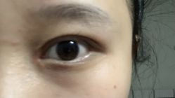 -美瑞莎创美医疗美容