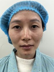 体验前-上海伊莱美医疗美容医院