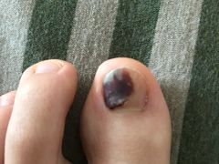 -杨一刀修脚(马连道南街店)