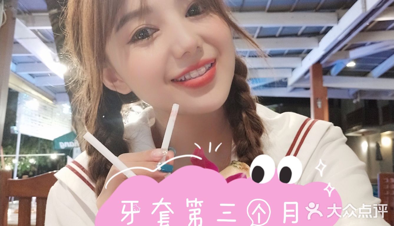 牙齿矫正案例 虎牙小美女逆袭日记