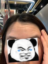 体验后-深圳美莱医疗美容医院