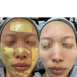 -SKIN79皮肤管理中心