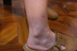 -雲艺刺青·洗纹身