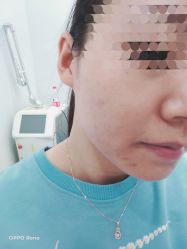 体验前-禾美嘉医疗美容