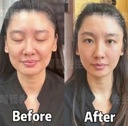 -颜和骨正&明星徒手小颜整骨