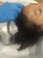 -大麦微针植发全国连锁