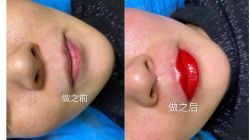 -重庆联合丽格第五医疗美容医院