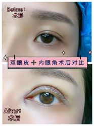 -西安现代妇产医院医疗美容