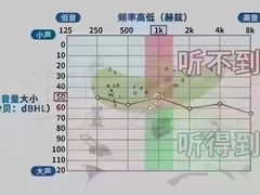 -自然之声助听器·呼吸机(公园路店)