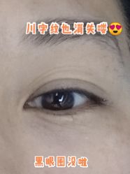 体验后-JS医疗美容