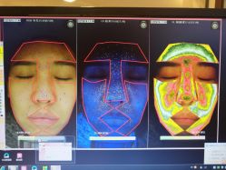 皮肤检测-光SPA科技美肤