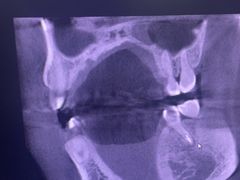 -土豆口腔(凤凰北总店)