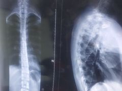 -张钰强中医正骨推拿连锁(华发商都店)