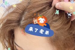 -大麦微针植发全国连锁