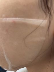 -美瑞莎创美医疗美容