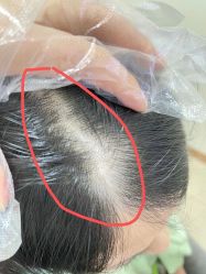 点击看大图 -新生植发·植养护一体