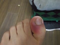 -世龙世家灰指甲·甲沟炎·跖疣护理·修脚(东江湾路店)