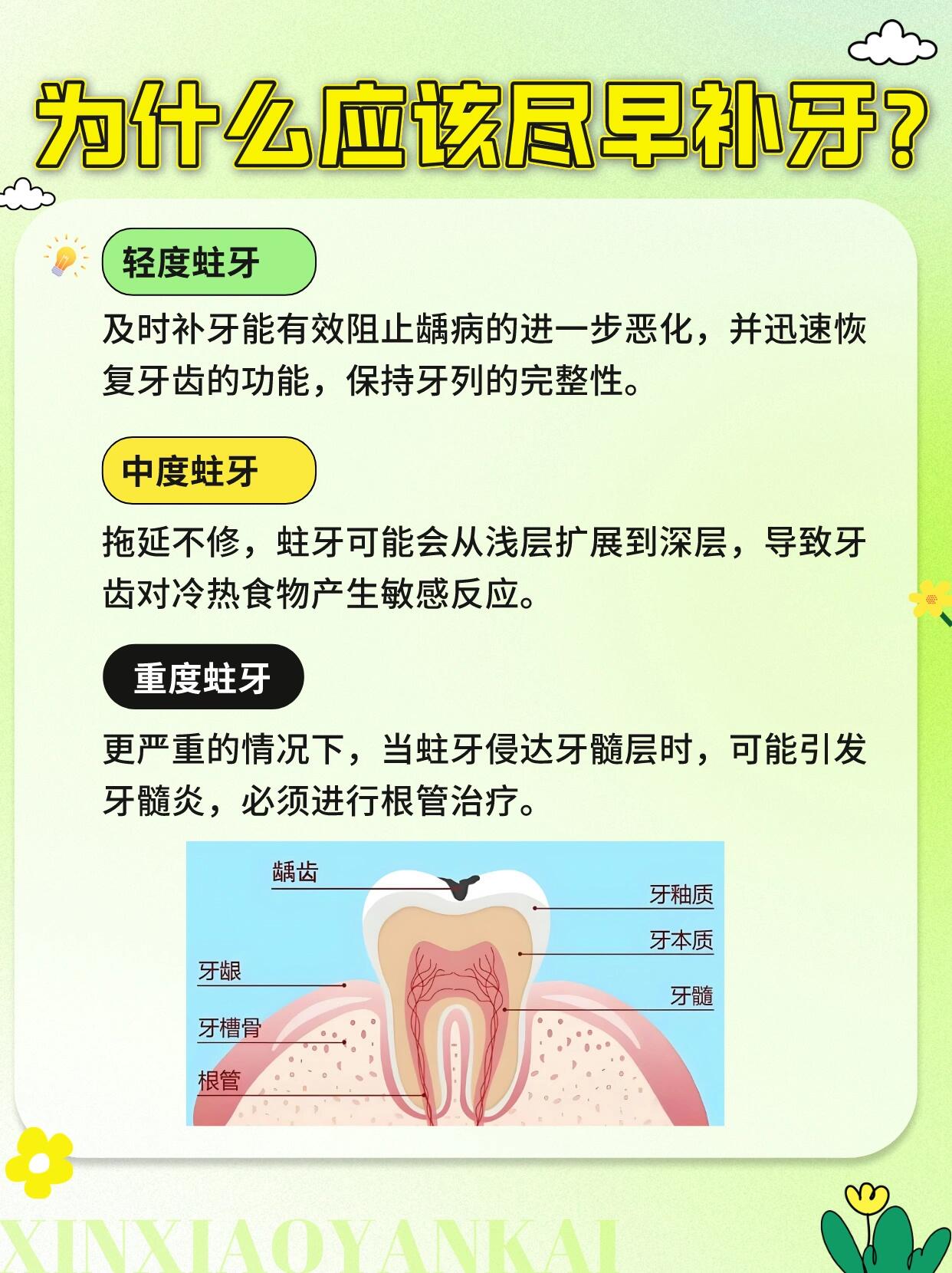 蛀牙可以恢复小窍门图片