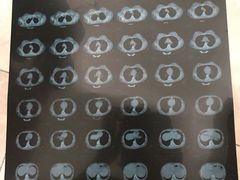 -天津医科大学第二医院