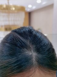 -熙朵美学植发·连锁品牌