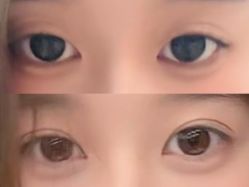 -JustHer宁波珈禾医疗美容医院