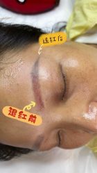 -德绣·机器野生眉发际线·美瞳线半永久