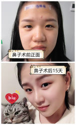-素美医疗美容·西南眼鼻整形·修复基地