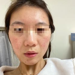 -Yestar艺星医疗美容医院