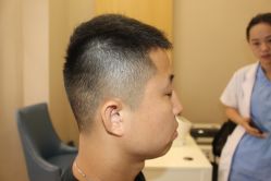 -大麦微针植发丨全国连锁