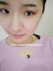 体验后-西美医疗美容门诊部