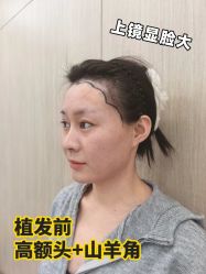 -雍禾植发