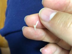 -朋朋修脚·灰指甲·甲沟炎·跖疣(人民路店)