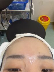 体验后-金圣医疗美容