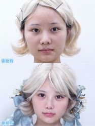 -Yestar重庆艺星医疗美容医院