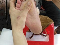 -郑远元专业修脚房(栖山路店)