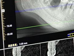 -深圳麦芽口腔医院(罗湖总院)