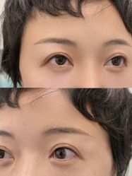 -张小野·专业半永久纹眉