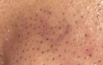 -Cream88颜皮肤管理中心