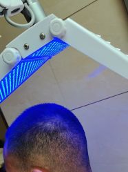 -碧莲盛·不剃发植发